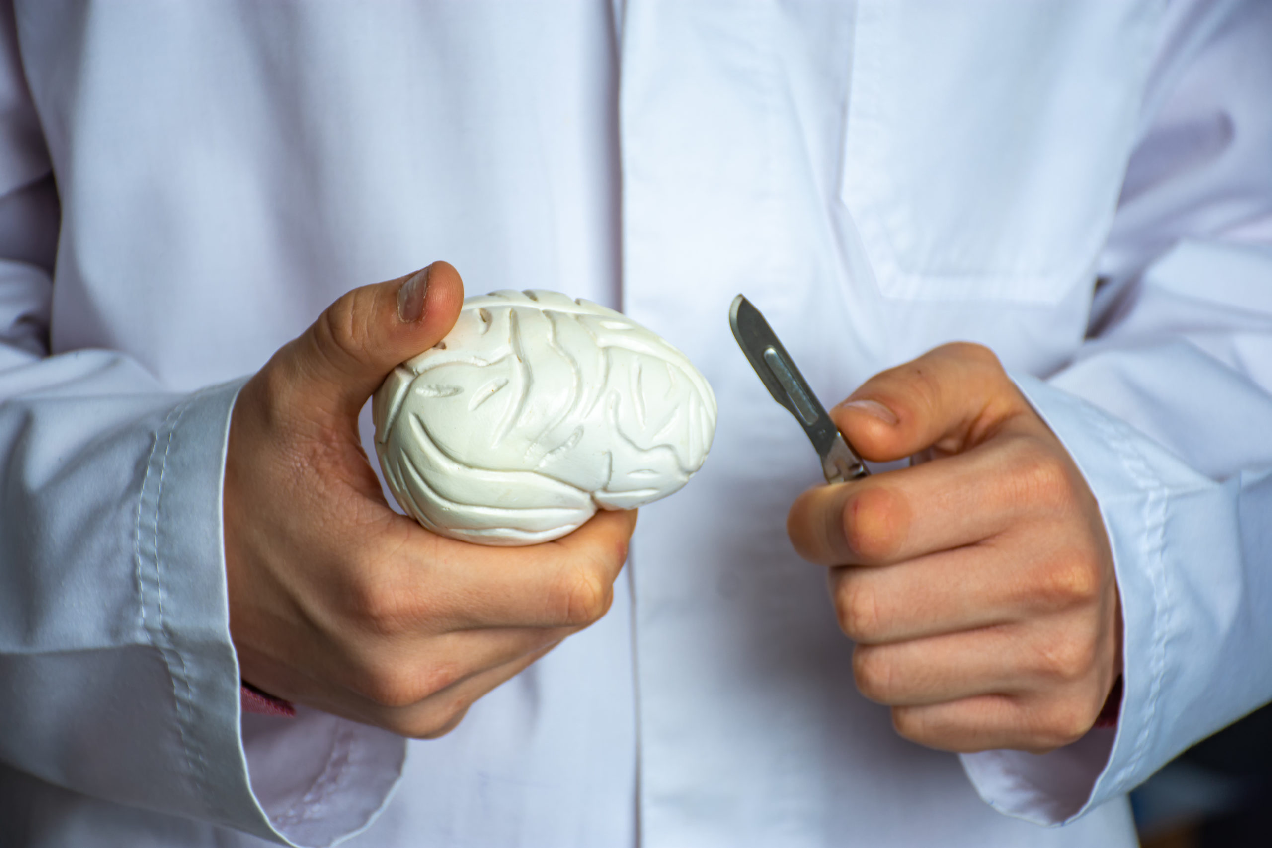 Concept Of Brain Surgery Or Neurosurgery. Neurosurgeon Holding Scalpel In Hand Over 3d Anatomical Model Of Human Brain. Brain Surgery Operations For Treatment Of Diseases Tumor, Aneurysm, Epilepsy